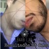 BARB LAB Vroloxidil Para El Crecimiento De Barba - Barb