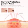 GOKOCO Parches para Acné 306 Pack, Estrella de 6 colores
