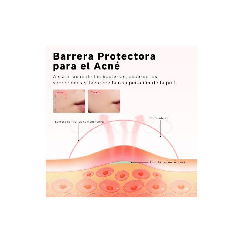 GOKOCO Parches para Acné 306 Pack, Estrella de 6 colores