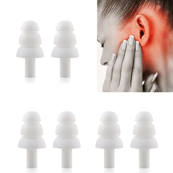 Ear Acupoint Massage Pulse Device Tinnitus Relief for Ringing Ears,