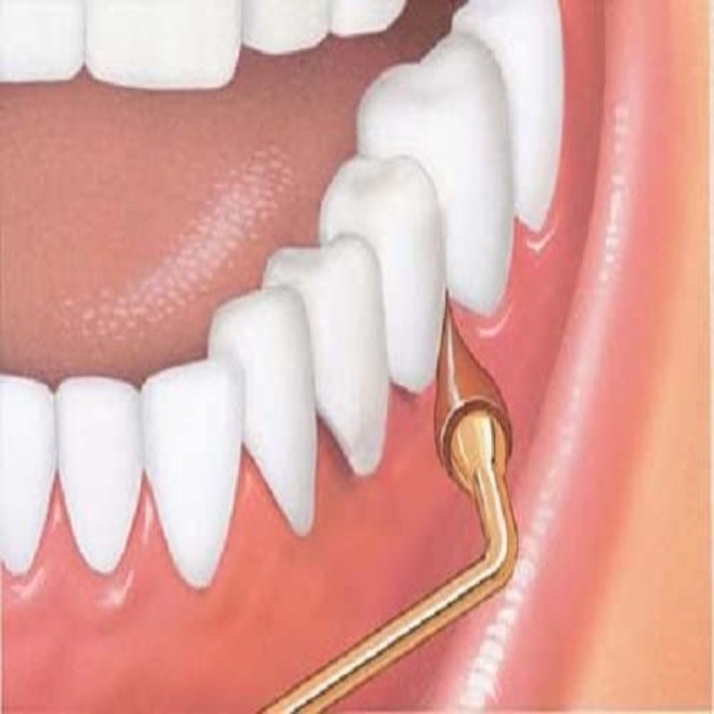 GUM Stimulator Permanent Handle - Long Handled Massager Remove Plaque