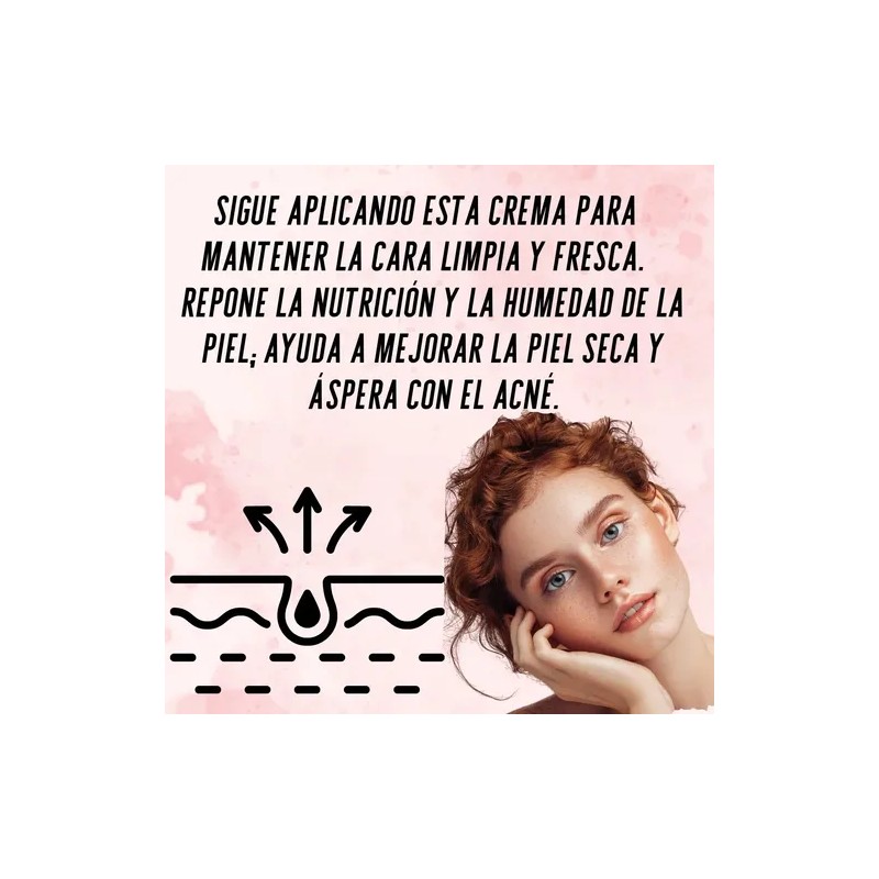 Cuidado Facial Crema Eliminación De Acné Senana Marina 1pz