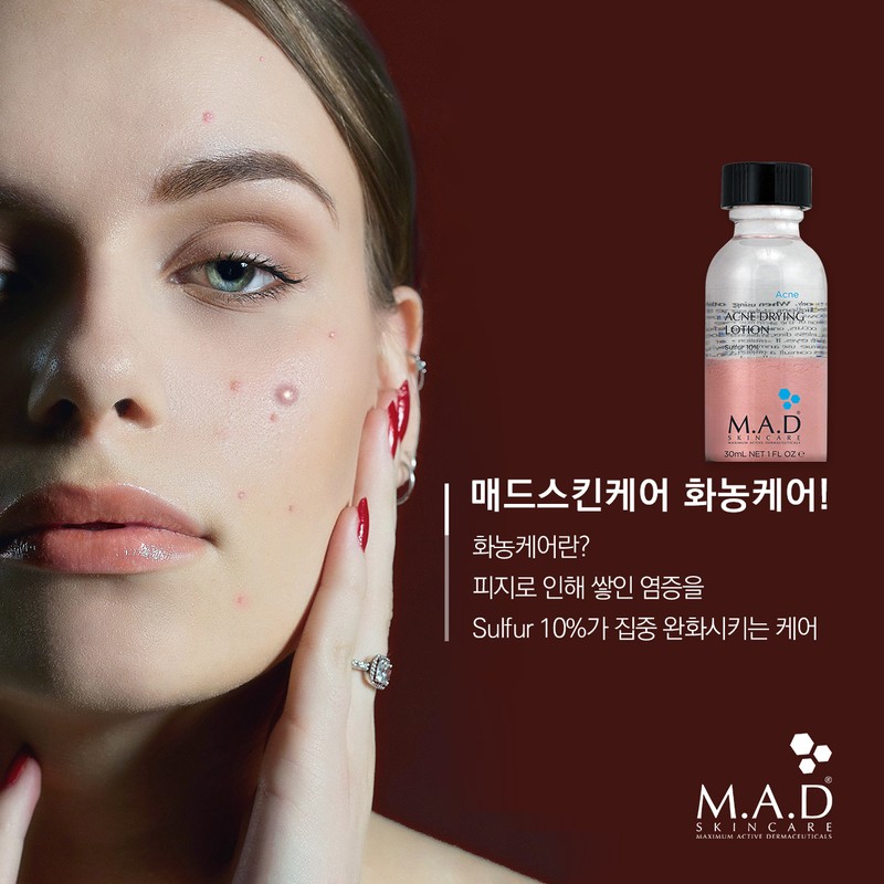 Mad Skin Care Acne Drying Lotion 30ml 1.Acne Drying Lotion