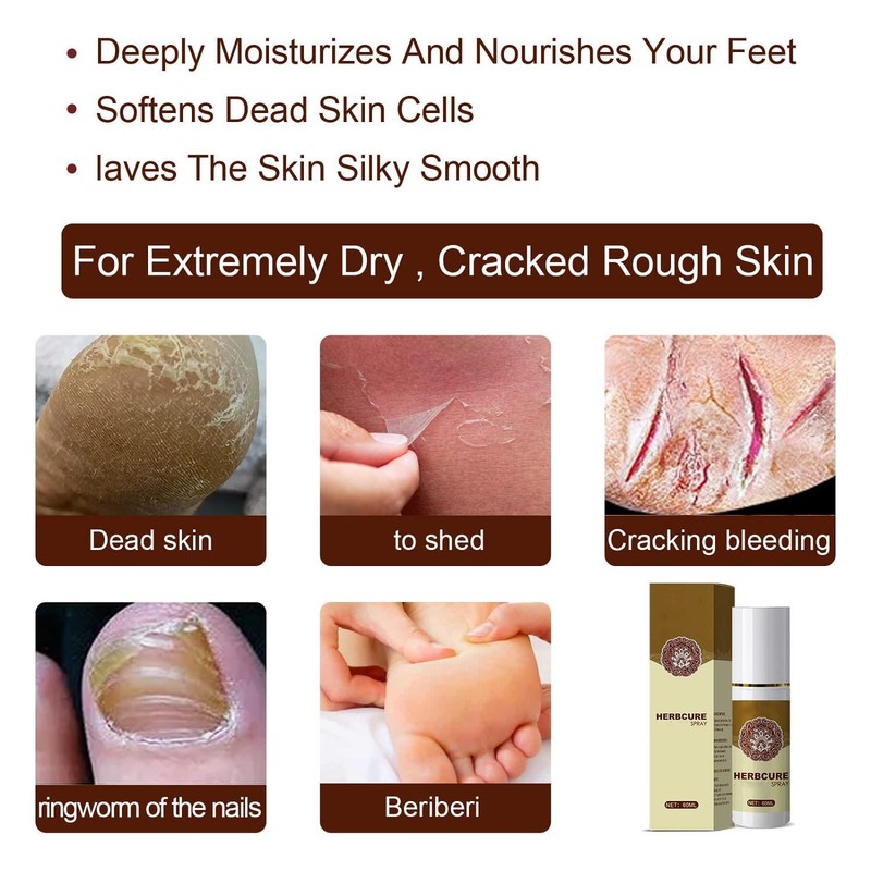 YG LianKai 3Pcs Feet Spray, Athlete's Foot Spray,Herbal Foot Peeling