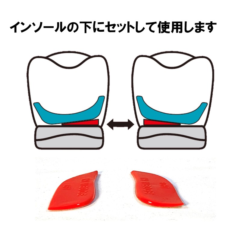 Asi Supplement WG1 In-Wedge, Angle Parts, Flat Feet, Elevates Inside