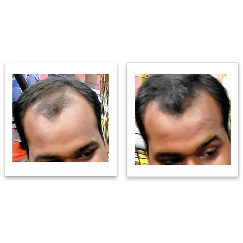 Caboki 10X Hair Powder - Trial Size:_Dark Brown