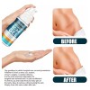 - Crema For Cicatrices Dzhzuj,gel De Silicona For Cicatrices