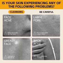 2PCS Turmeric Soap Bar - Natural Kojic Acid & Turmeric Soap for Body & Face, Even Skin Tone, Acne, Dark Spots, Hyperpigmentation, Smooth Skin, Firming Pores, Deep Cleansing, for All Skin Type 100g