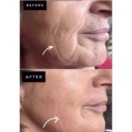 Nu Skin NuSkin ageLOC Tru Face Essence Ultra Uplifting Cream, *NEW* EXP. 12/2027