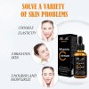Sérum De Vitamina C Con Ácido Hialurónico, 30 Ml