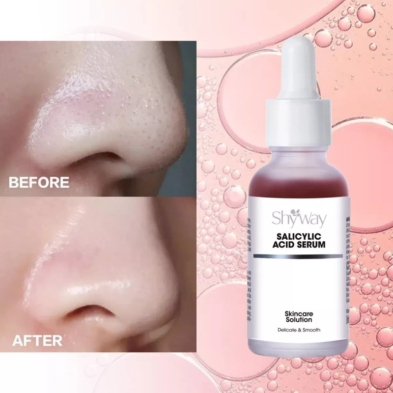 Shyway Suero Metabólico Profundo Con Queratina Shyway U S A