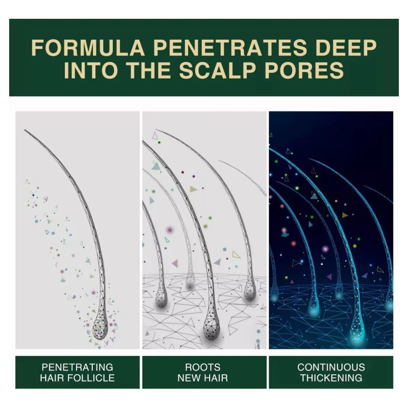 Tratamiento Para Exceso Caida Cabello Mujer Fortalece 30ml