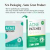 600pcs Pimple Patches Hydrocolloid Acne Stickers Spot Cover Patches