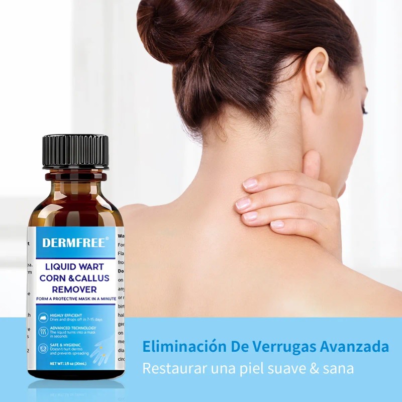 Líquida Eliminación De Verrugas,verrugas Plantare Y Comune