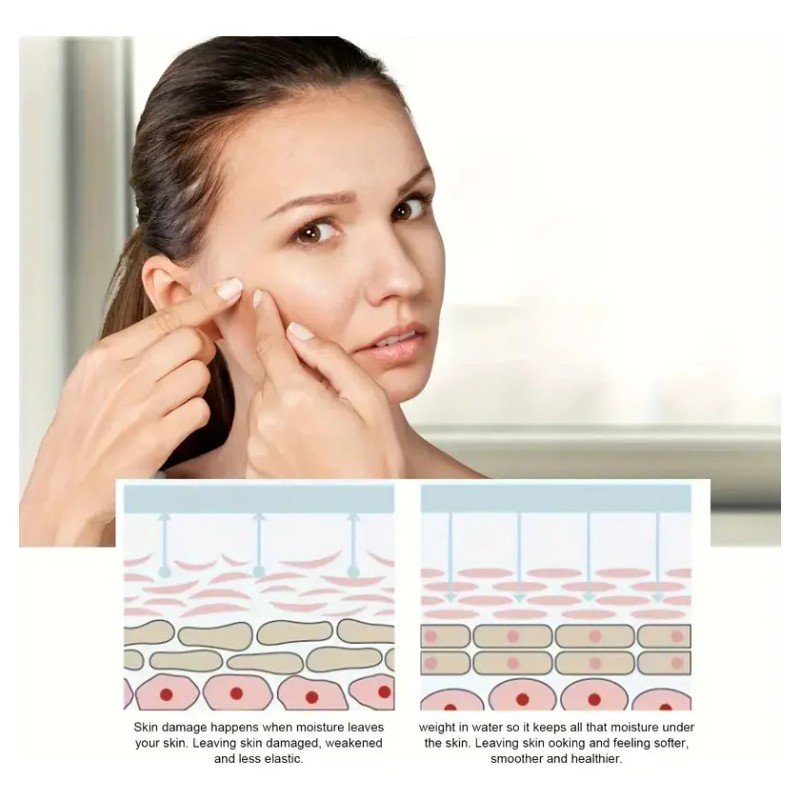 Sérum Facial Blanqueador De Pecas Con Sandía Y Eliminación