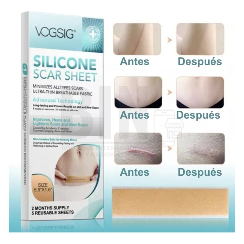 Hojas De Silicona Ayuda A Eliminar Cicatrices Acné Queloide