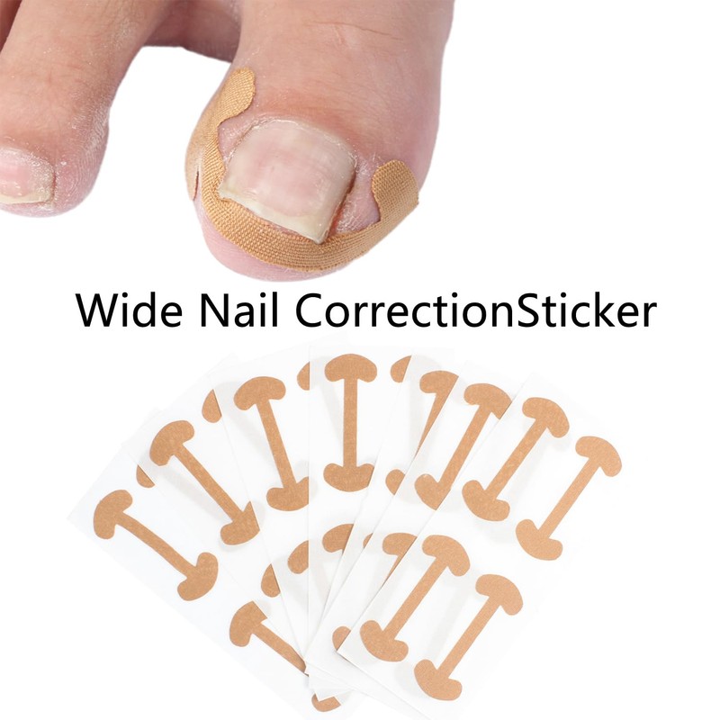 CHEMAILON Professional Ingrown Toenail Correction Kit - Stainless Steel Ingrown