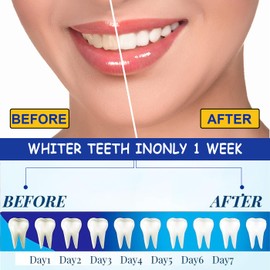 MUNSKT Teeth Whitening Strips,Tooth Whitening Kits, Teeth Whitener, Tooth Whitening Kits, 28 Pcs Teeth Whitening Strips,Teeth Whitener Kits Tooth Whitening Kits Enamel Safe Non-Sensitive at Home