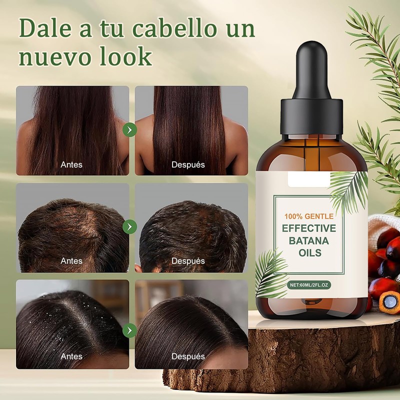BSMKD 2 Piezas Aceite de Batana, 60ml Batana Hair Oil,