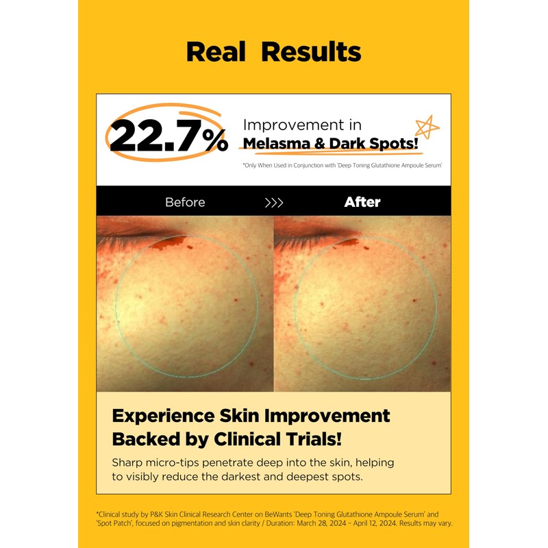 Bewants Deep Toning Glutathione Spot Patch – Micro Tip Patches