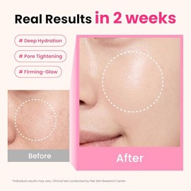 PDRN Glass Glow Serum – Reafirmante de la piel y apriete los poros, cuidado de barrera, ácido hialurónico 10 + 2% niacinamida, hidratante, manchas osc