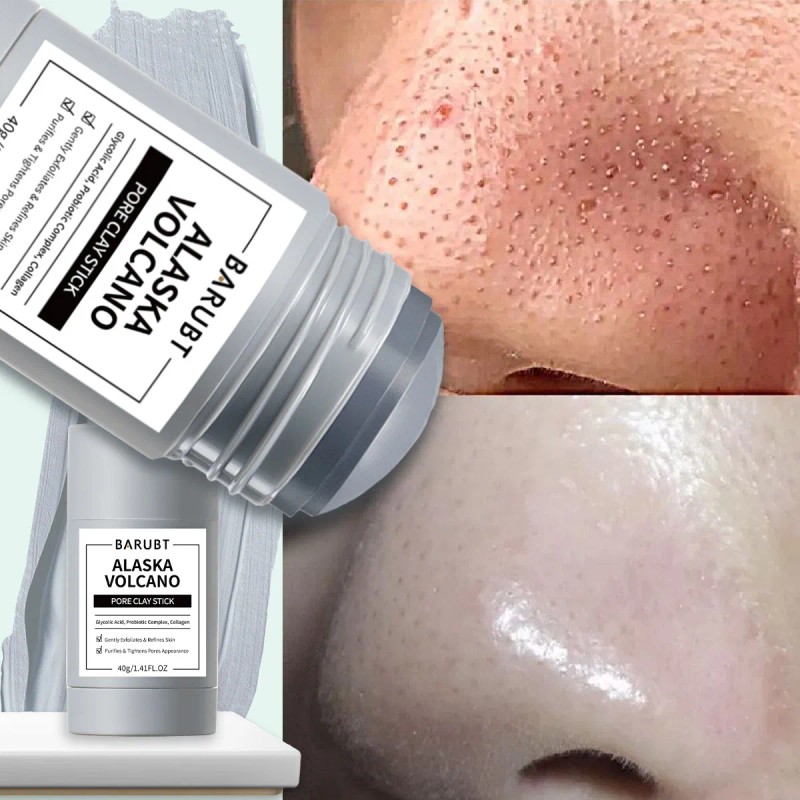 Mascarilla Facial De Arcilla Para Puntos Negros 40 G