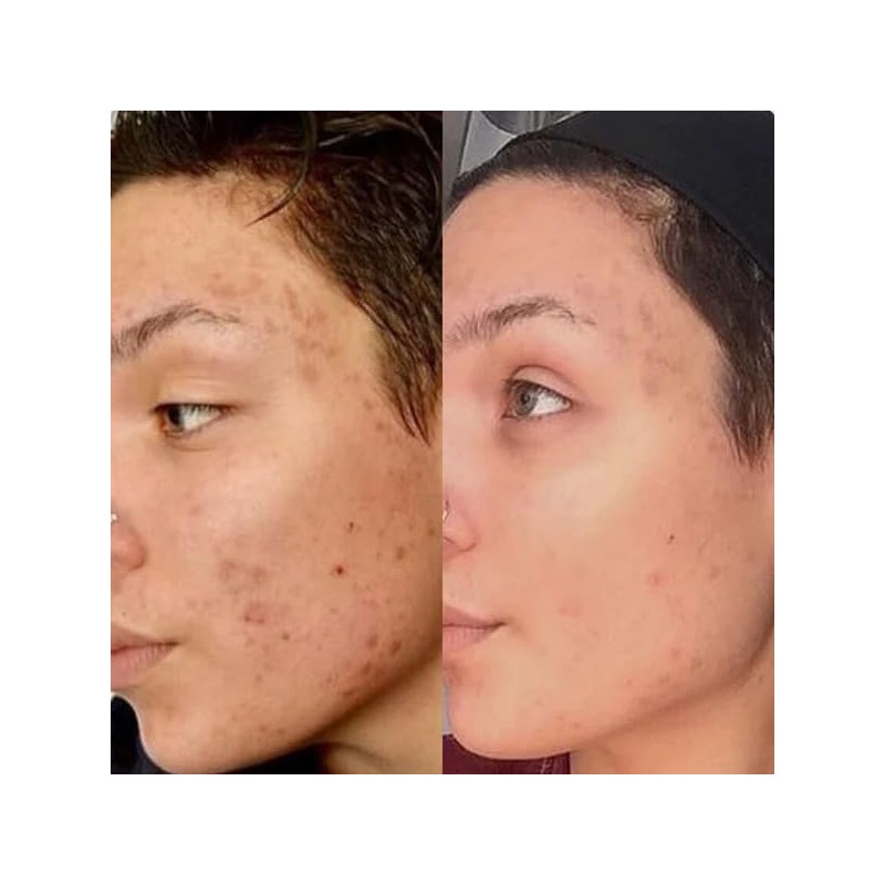 Gin Amber Beauty - Natural 20% Vitamin C Booster -