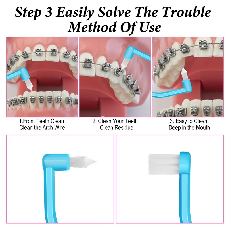 6 Pcs Soft Interdental Brushes Small-Head Orthodontic Toothbrush Teeth Detail