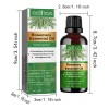 Aceite Esencial De Romero Para El Crecimiento Del Cabello