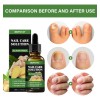 3pcs Suero Uñas Jengibre Cuidado Mopoyat