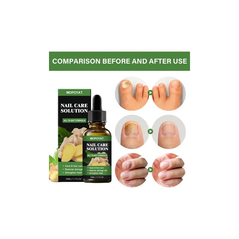 3pcs Suero Uñas Jengibre Cuidado Mopoyat