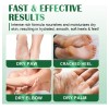 M Exfoliante Suave Para Pies Secos Y Crema Rica Para