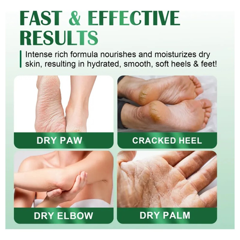 M Exfoliante Suave Para Pies Secos Y Crema Rica Para