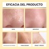 Cremas Tiras Elimina Puntos