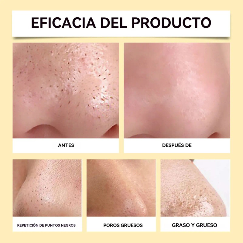 Cremas Tiras Elimina Puntos