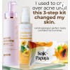 Her Choice PH Set C: Kojic Soap, Body Lotion &