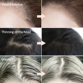 Boobeen Hair Powder for Thin Hair, Root Touch Up Powder Hair Shadow for Instant Loss, Hairline Powder (For Women) for Men Dark Brown