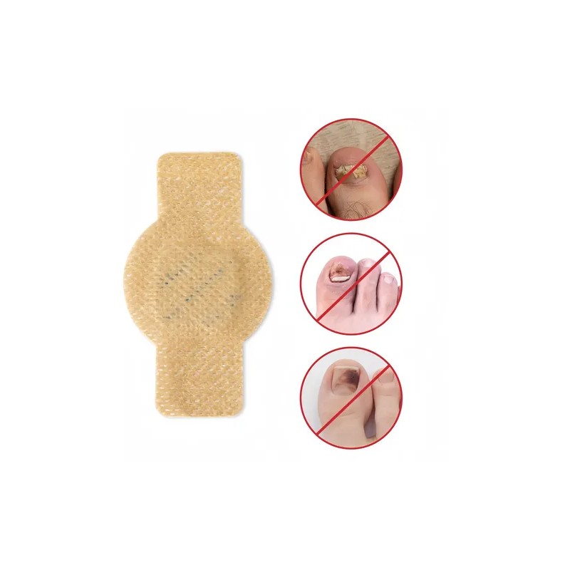 30pz Parches Antimicóticos For El Tratamiento De Uñas
