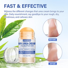 CHANGARLOAD Urea Cream 60 Percent For Feet Maximum Strength - Intensive Repair Dry Cracked Skin, Urea Cream For Feet, Foot Cream For Dry Cracked Heels, 1 Pcs - 1.41 Oz