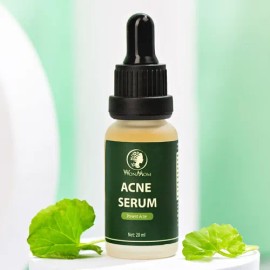 Suero Para El Acné (0.7 Fl Oz)