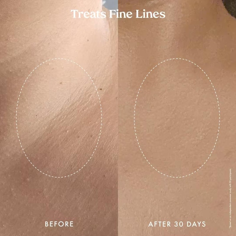 Kopari Ultra Renewal Retinol Body Cream, Infused with Acai &