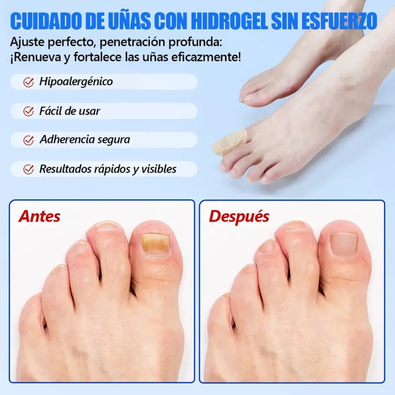 Parches Para Uñas Fúngicos 63pzs Caja De Parches Dañadas