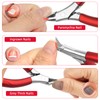 AOOWU Toenail Clippers for Ingrown Toenail, Straight Blade Podiatrist Nail
