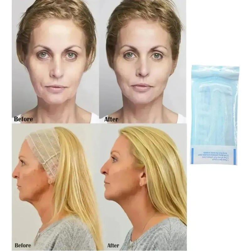 Hilos de Colágeno LUJITO para Rejuvenecer e Hidratar Piel, 60