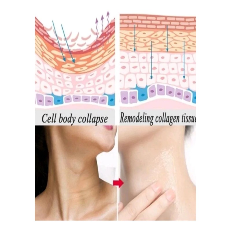 Crema Para Reducir Papada Tonificar Cuello Adelgaza Reafirma Fresh