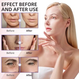 Wrinkle Filler for Deep Wrinkles Instantly,Instant Face Lift Tightening Cream&Wrinkle Remover,Best Wrinkle Filler with Deep Moisturizing&Hydrating,Anti-Aging Skin Tightening Cream for Face and Neck