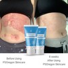 PSOregon Maintenance Cream for Sensitive & Scaly Skin – Non-Greasy