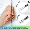 Ultimate Blackhead Removal Skincare Tools Set, Vidal Loops, Uno Spoon,