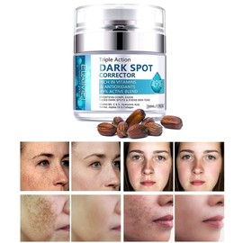 Dark Spot Remover for Face, Fast-Acting Dark Spot Corrector Remover for Face and body Hyperpigmentation, Fades Melasma, Freckle, Sun Spots, Evens Skin Tone, Age Spot Remover for Women Men