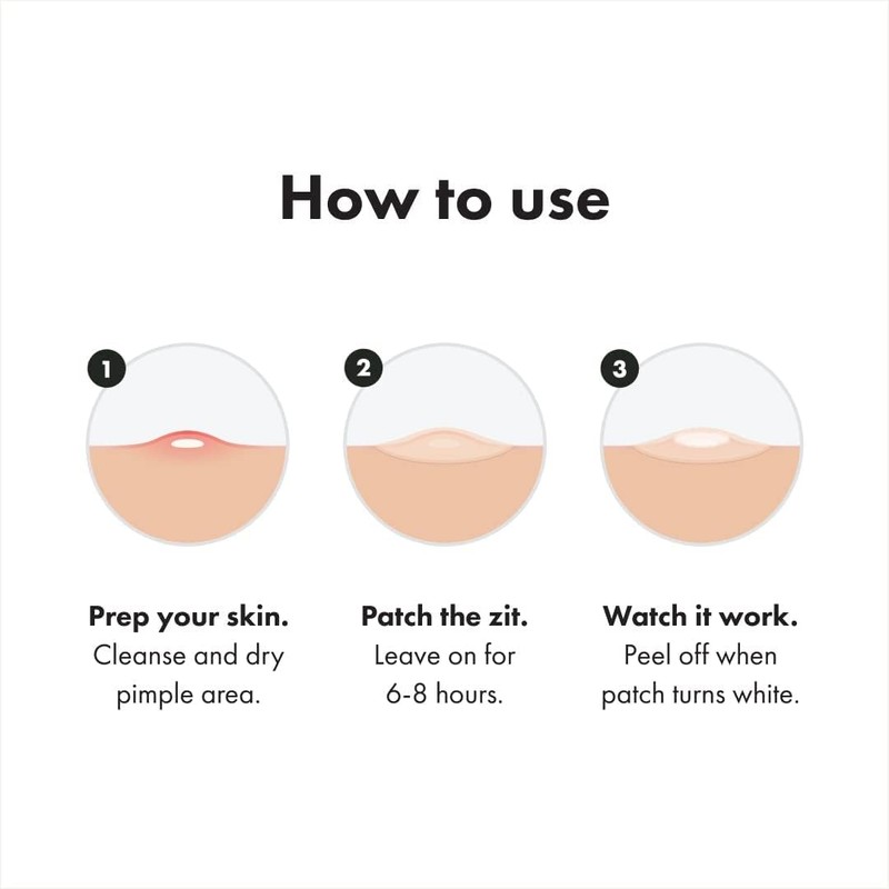 a.l.m. Magical Patch: Hydrocolloid pimple patches. These ultra thin &